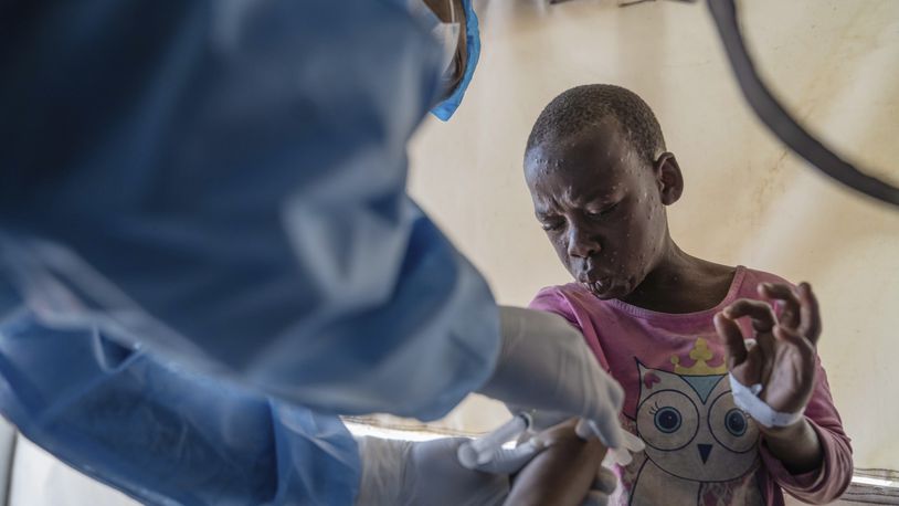 FILE - A health worker attends to an mpox patient, at a treatment center in Munigi, eastern Congo, Aug. 19, 2024. (AP Photo/Moses Sawasawa, File)