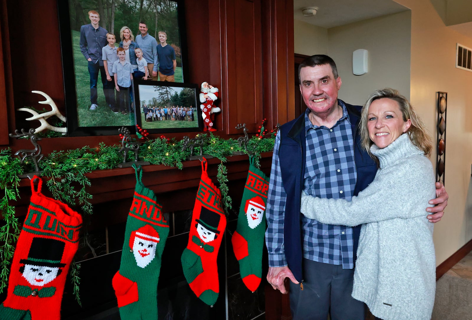 Kevin Pleiman and his wife, Shelly, are grateful Kevin is around to celebrate this Christmas with their family. Kevin suffered burns over 70% of his body after an explosion last December and wasn't expected to live. BILL LACKEY/STAFF