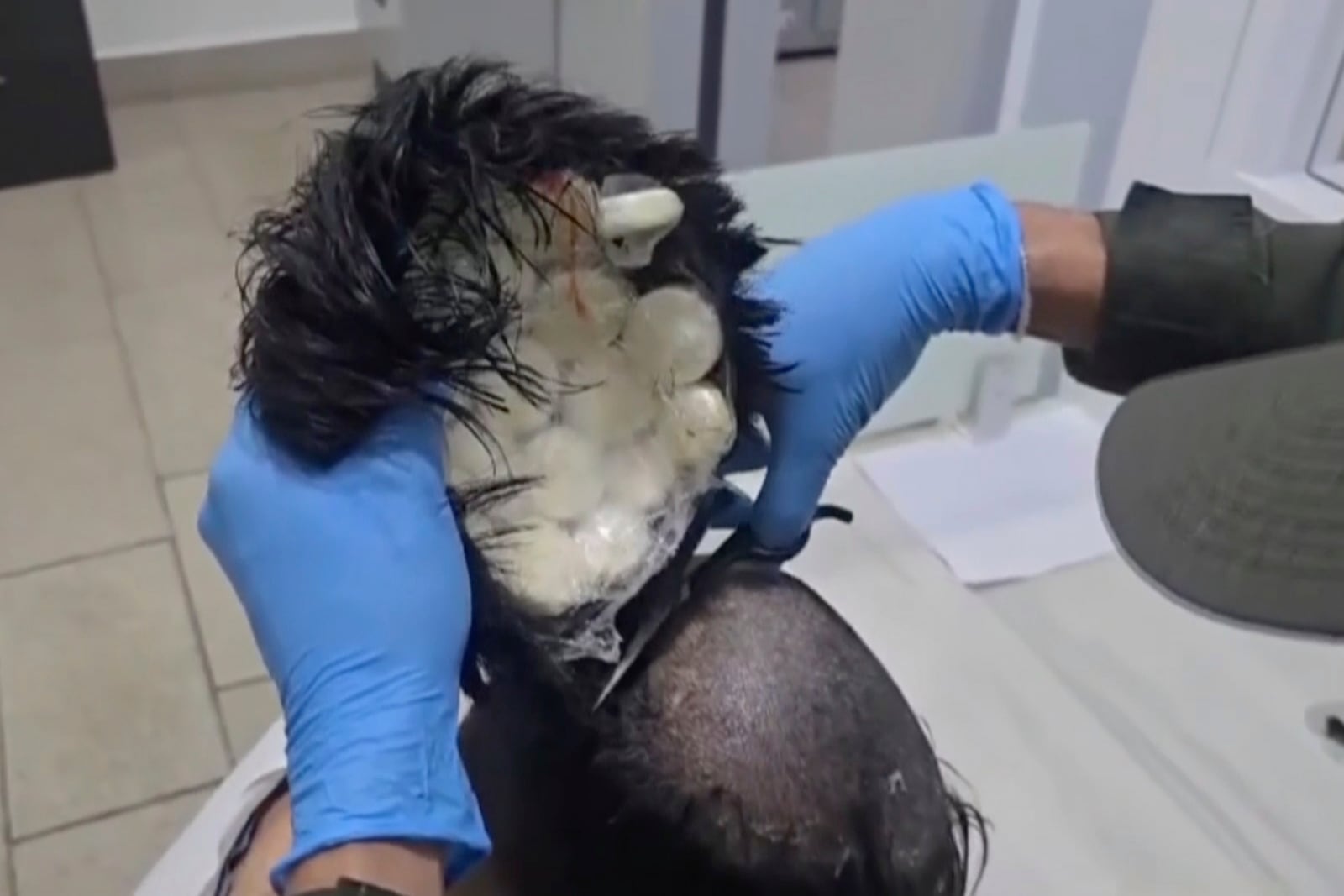 In this screenshot taken from a video provided by the Colombian National Police, Colombian police catch a man smuggling packets of cocaine under his toupee at the airport in Cartagena, Colombia, Monday, Feb. 24, 2025. (Via Colombian National Police)