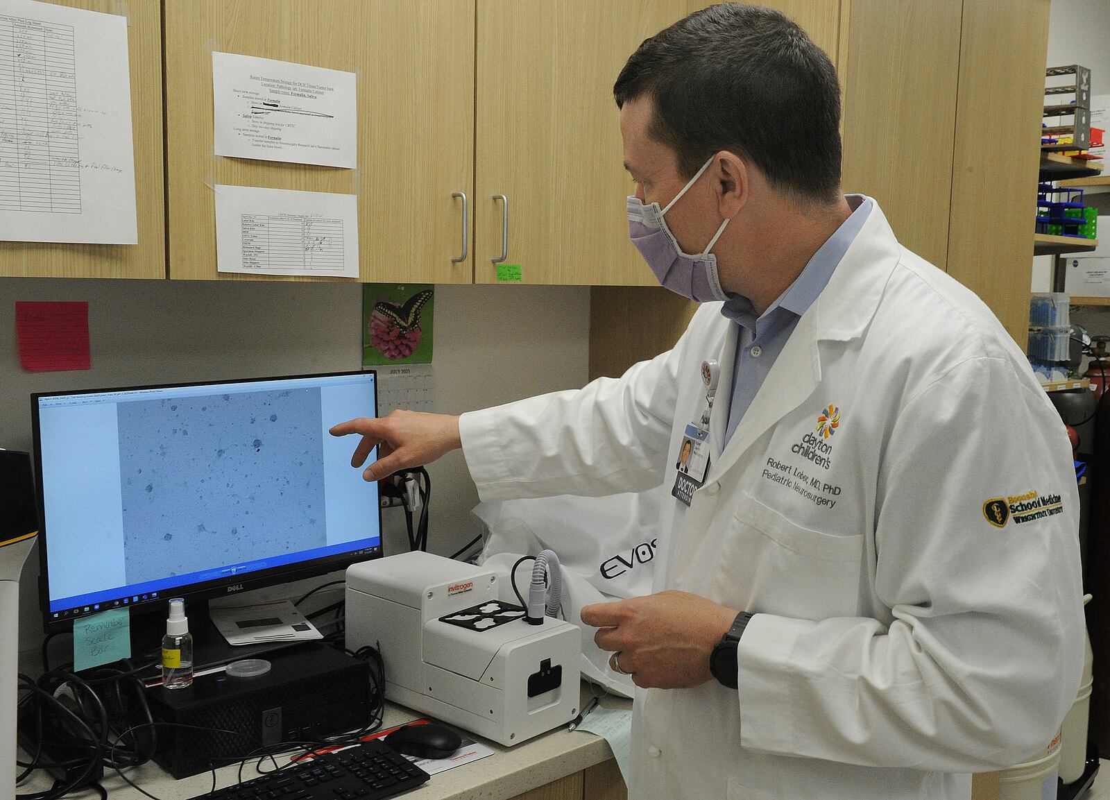 Dr. Robert Lober points to an image of a high grade glioma from a child that did not survive, which was donated as part of the biobank. MARSHALL GORBY\STAFF