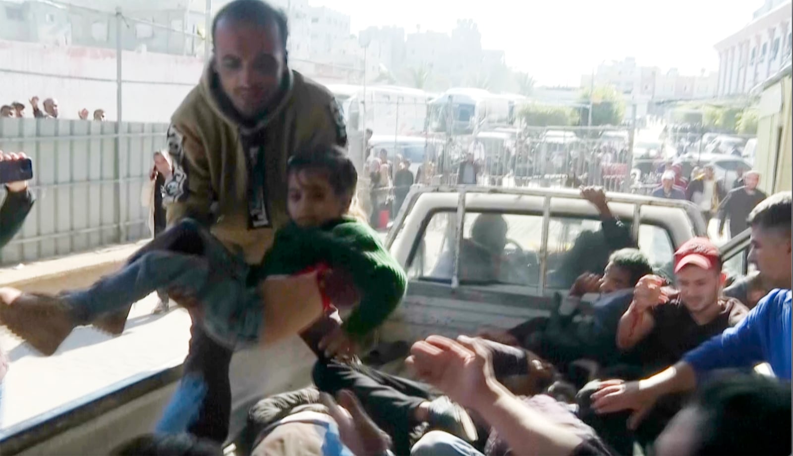 An injured child unloaded from vehicle at Nasser hospital in Khan Younis after an Israeli airstrike on Saturday, Nov. 30, 2024. (AP Photo)