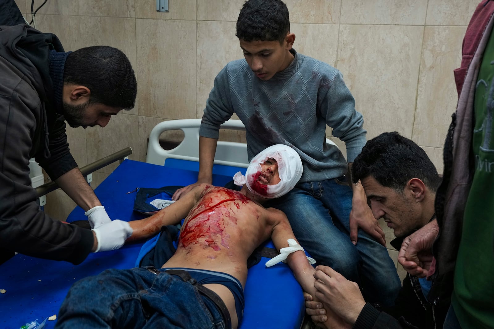 A wounded child receives treatment at Al-Aqsa Martyrs Hospital following Israeli army airstrikes, in Deir al-Balah, central Gaza Strip, Saturday Jan. 4, 2025.(AP Photo/Abdel Kareem Hana)