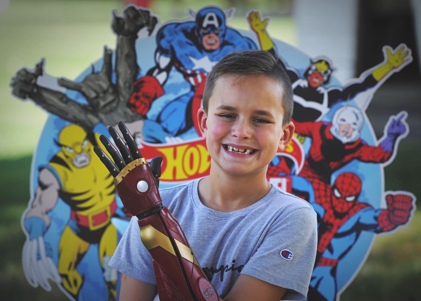 Boy has 'Iron Man' arm