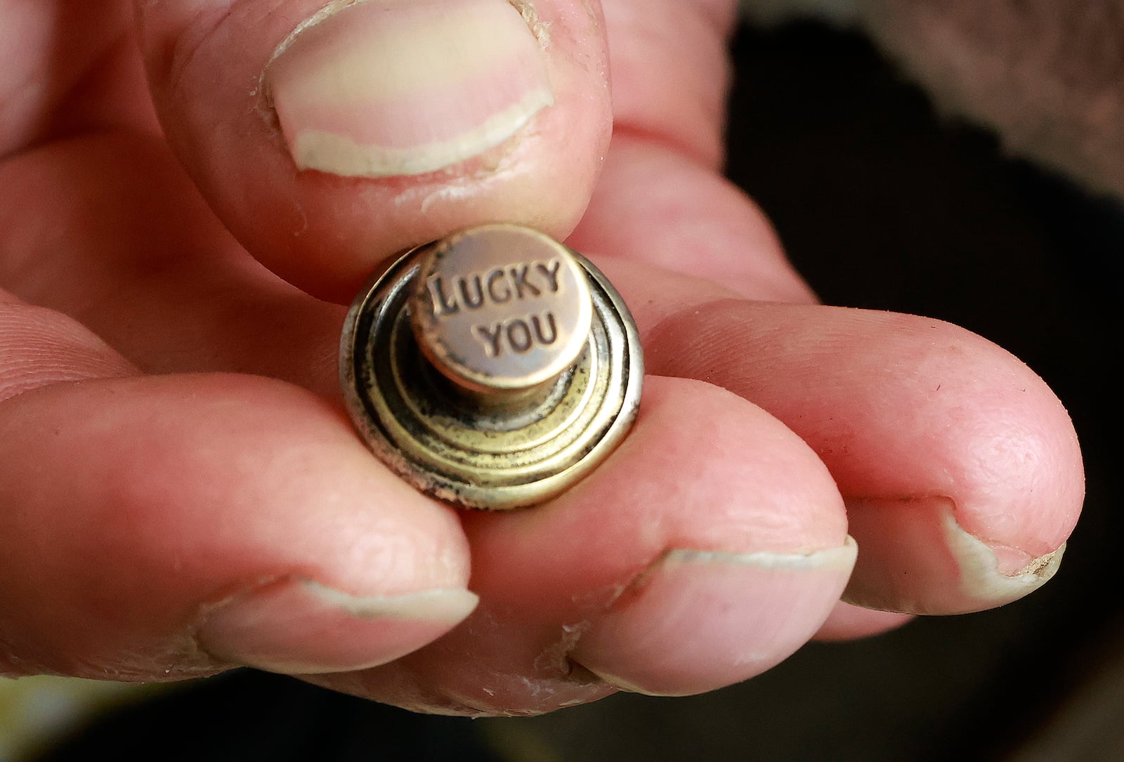 The only thing left of Kevin Pleiman's pants after the explosion was the button, which reads "Lucky You." BILL LACKEY/STAFF