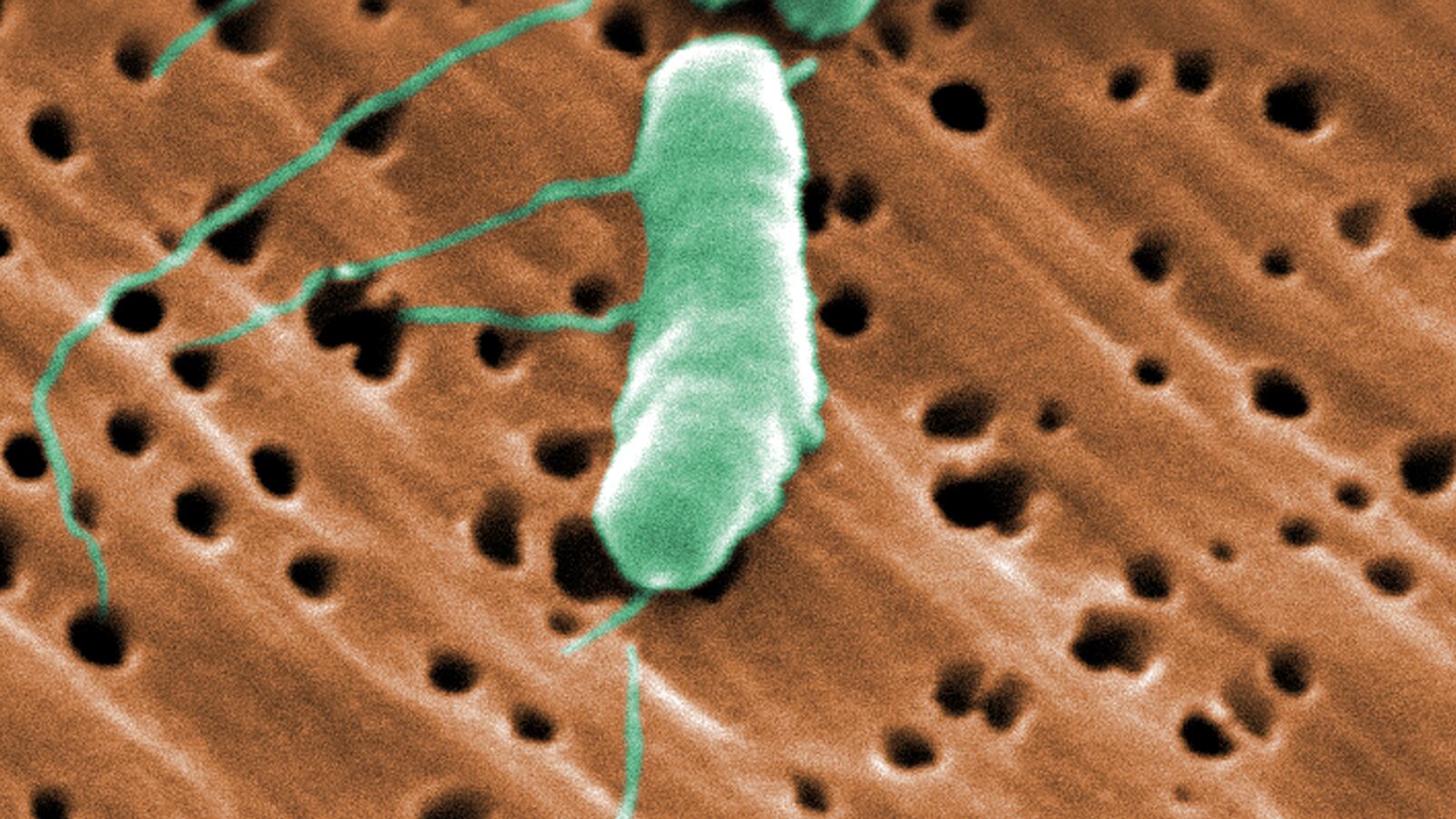 Under a high magnification of 26367X, this digitally-colorized scanning electron microscopic (SEM) image depicted a flagellated Vibrio vulnificus bacterium.