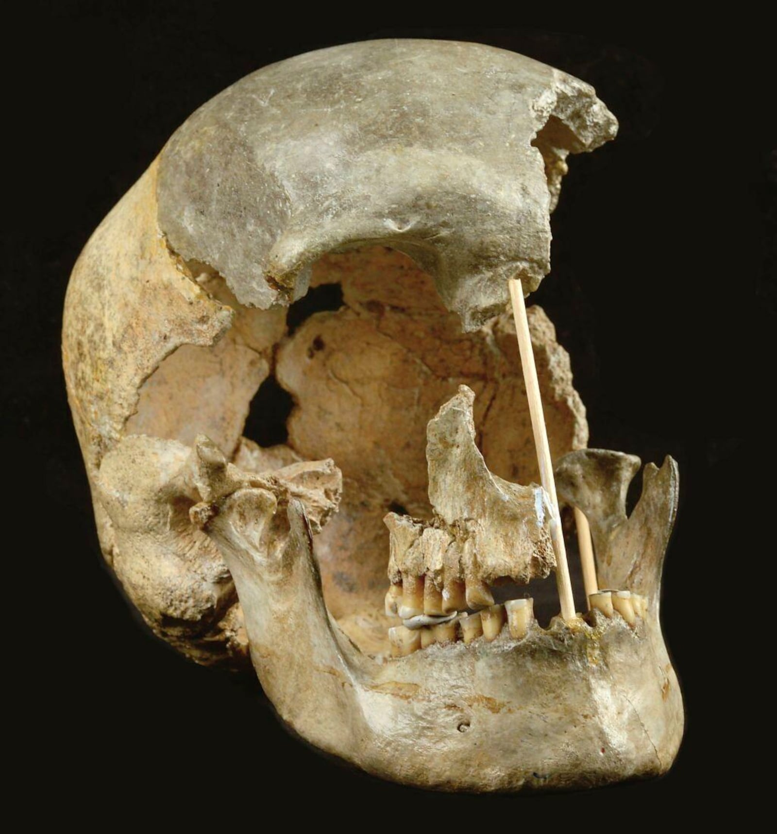 This image provided by National Museum, Prague shows the skull of an ancient human called Zlatý kůň, originally discovered in the Koněprusy caves of the Czech Republic. (Marek Jantač/National Museum, Prague via AP)